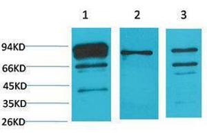 Western Blotting (WB) image for anti-Calnexin (CANX) antibody (ABIN3181566) (Calnexin 抗体)
