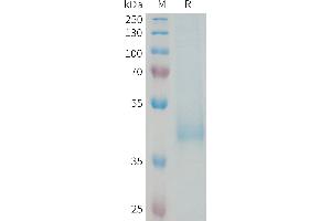 Human DL3 Protein, His Tag on SDS-PAGE under reducing condition. (KIR3DL3 Protein (AA 26-322) (His tag))