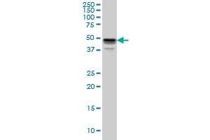 Western Blotting (WB) image for anti-MAP Kinase Interacting serine/threonine Kinase 1 (MKNK1) (AA 1-466) antibody (ABIN599046) (MKNK1 抗体  (AA 1-466))