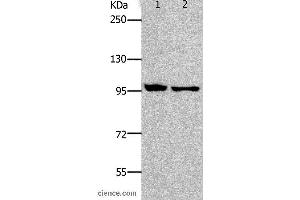 Western blot analysis of HT-29 and SKOV3 cell, using NFKB2 Polyclonal Antibody at dilution of 1:800 (NFKB2 抗体)