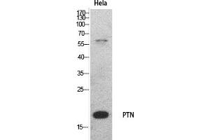 Western Blot analysis of hela cells using PTN Polyclonal Antibody. (Pleiotrophin 抗体  (Internal Region))