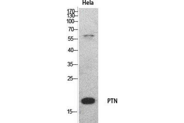 Pleiotrophin 抗体  (Internal Region)