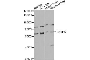 Western blot analysis of extracts of various cell lines, using GABPA antibody. (GABPA 抗体)