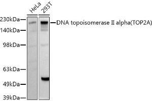 Western blot analysis of extracts of various cell lines, using DNA topoisomerase II alpha (TOP2A) antibody (ABIN7270853) at 1:1000 dilution. (Topoisomerase II alpha 抗体  (AA 1050-1150))