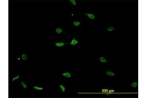Immunofluorescence (IF) image for anti-Proteasome (Prosome, Macropain) Subunit, beta Type, 8 (Large Multifunctional Peptidase 7) (PSMB8) (AA 173-272) antibody (ABIN562483)