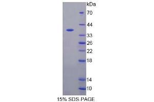 SDS-PAGE analysis of Mouse S17aH Protein. (CYP17A1 蛋白)