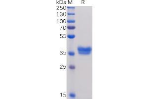 Human BCMA, mFc Tag on SDS-PAGE under reducing condition. (BCMA Protein (AA 1-54) (mFc Tag))