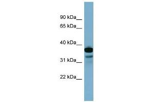 FLJ25791 antibody used at 1 ug/ml to detect target protein. (FLJ25791 (Middle Region) 抗体)