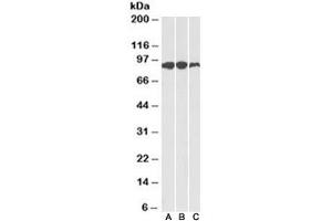 Western blot of human (A), mouse (B) and rat (C) adipose lysates with Aconitase 2 antibody at 0. (ACO2 抗体)