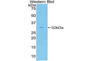 Western blot analysis of the recombinant protein. (Caspase 12 抗体  (AA 1-244))