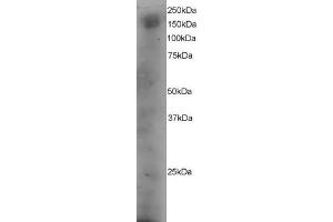 Western Blotting (WB) image for anti-Dedicator of Cytokinesis 1 (DOCK1) (C-Term) antibody (ABIN2465608) (DOCK1 抗体  (C-Term))