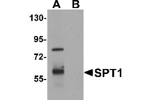 Western blot analysis of SPT1 in human lung tissue lysate with SPT1 antibody at 1 µg/mL in (A) the absence and (B) the presence of blocking peptide. (SPTLC1 抗体  (C-Term))