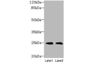 Western blot All lanes: TIMP3 antibody at 2 μg/mL Lane 1: EC109 whole cell lysate Lane 2: 293T whole cell lysate Secondary Goat polyclonal to rabbit IgG at 1/10000 dilution Predicted band size: 25 kDa Observed band size: 25 kDa (TIMP3 抗体  (AA 30-208))