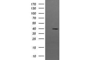 Image no. 2 for anti-Mitogen-Activated Protein Kinase Kinase 3 (MAP2K3) antibody (ABIN1499420) (MAP2K3 抗体)