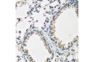 Immunohistochemistry of paraffin-embedded mouse lung using BMP2 antibody. (BMP2 抗体)