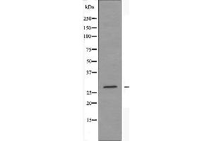 Western blot analysis of extracts from rat brain cells, using AQP1 antibody. (Aquaporin 1 抗体  (Internal Region))