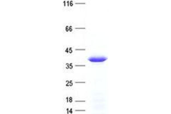 WBSCR22 Protein (His tag)