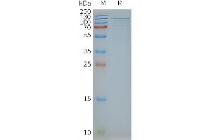 Human TSHR-Nanodisc, Flag Tag on SDS-PAGE (TSH receptor 蛋白)