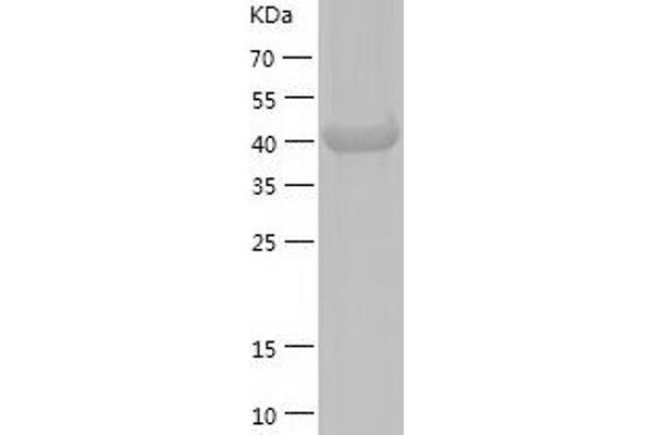 STAMBP Protein (AA 1-424) (His tag)