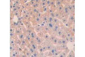 Used in DAB staining on fromalin fixed paraffin- embedded Kidney tissue (BCL10 抗体  (AA 1-233))