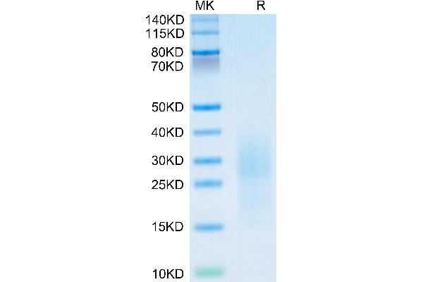 PSCA Protein (AA 21-95) (His tag)