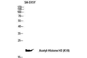 Western Blot (WB) analysis of SH-SY5Y lysis using Acetyl-Histone H3 (K18) antibody. (Histone 3 抗体  (H3K18ac))