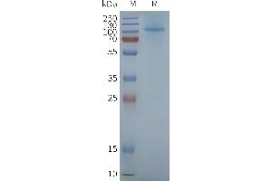 Human R3-Nanodisc, Flag Tag on SDS-PAGE (TAS1R3 蛋白)