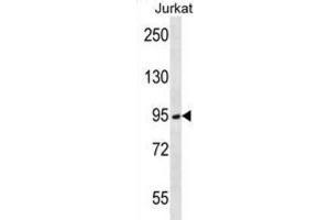 Western Blotting (WB) image for anti-Transmembrane Protease, serine 15 (TMPRSS15) antibody (ABIN2996619) (TMPRSS15 抗体)