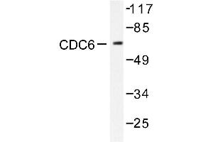 Image no. 1 for anti-Cell Division Cycle 6 Homolog (S. Cerevisiae) (CDC6) antibody (ABIN265343) (CDC6 抗体)