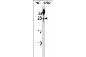 Western blot analysis in NCI-H292 cell line lysates (35ug/lane). (Tetraspanin 2 抗体  (N-Term))