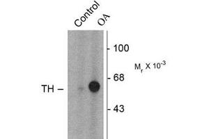 Image no. 2 for anti-Tyrosine Hydroxylase (TH) (pSer31) antibody (ABIN227933) (Tyrosine Hydroxylase 抗体  (pSer31))