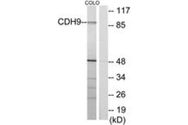 Cadherin 9 抗体  (AA 201-250)