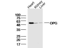 Western Blotting (WB) image for anti-Tumor Necrosis Factor (Ligand) Superfamily, Member 11 (TNFSF11) (AA 221-300) antibody (ABIN668556)