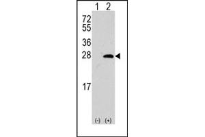 Image no. 1 for anti-sigma Non-Opioid Intracellular Receptor 1 (SIGMAR1) (Middle Region) antibody (ABIN357897) (SIGMAR1 抗体  (Middle Region))