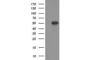 Western Blotting (WB) image for anti-Tumor Protein P53 (TP53) antibody (ABIN1499975) (p53 抗体)