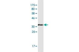 Western Blot detection against Immunogen (36. (CCL2 抗体  (AA 1-99))