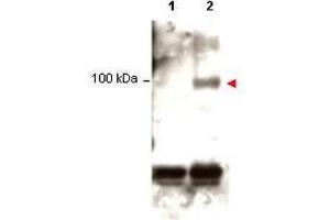Western blot using  Protein A purified anti-Stat1 pY701 antibody shows detection of phosphorylated Stat1 (indicated by arrowhead at ~91 kDa) in K562 cells after 30 min treatment with 1Ku of hIFN-? (STAT1 抗体  (pTyr701))
