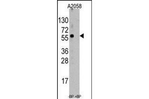 Western blot analysis of anti-ST13 Antibody pre-incubated with and without blocking peptide (BP6247a) in A2058 cell line lysate. (HSC70 Interacting Protein HIP 抗体  (AA 50-80))