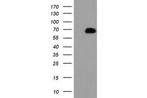 HEK293T cells were transfected with the pCMV6-ENTRY control (Left lane) or pCMV6-ENTRY PEX5 (Right lane) cDNA for 48 hrs and lysed. (PEX5 抗体)