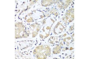 Immunohistochemistry of paraffin-embedded human stomach using RPH3AL antibody (ABIN5974449) at dilution of 1/100 (40x lens). (RPH3AL 抗体)