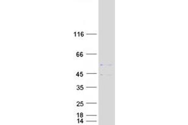 SLC25A3 Protein (Transcript Variant 1) (Myc-DYKDDDDK Tag)