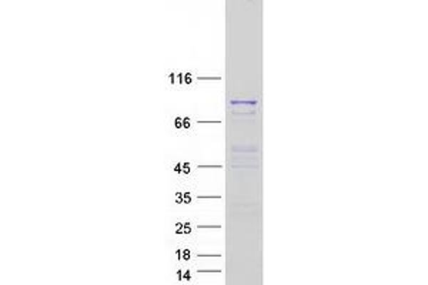 MSH5 Protein (Transcript Variant 4) (Myc-DYKDDDDK Tag)