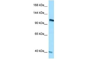 WB Suggested Anti-RET Antibody Titration: 1. (Ret Proto-Oncogene 抗体  (C-Term))