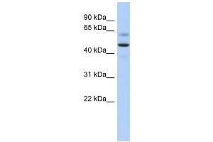 ARSA antibody used at 1 ug/ml to detect target protein. (Arylsulfatase A 抗体  (Middle Region))