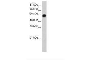 Image no. 2 for anti-Kelch-Like ECH-Associated Protein 1 (KEAP1) (C-Term) antibody (ABIN6736255) (KEAP1 抗体  (C-Term))