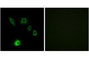 Immunofluorescence analysis of HuvEc cells, using FGF18 Antibody. (FGF18 抗体  (AA 151-200))
