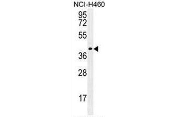 CCDC54 抗体  (Middle Region)