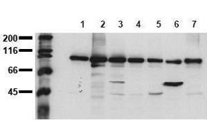 Western Blotting (WB) image for anti-Catenin (Cadherin-Associated Protein), beta 1, 88kDa (CTNNB1) (C-Term) antibody (ABIN126749) (CTNNB1 抗体  (C-Term))