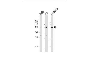 All lanes : Anti-PTEN Antibody (N-term) at 1:500-1:2000 dilution Lane 1: Hela whole cell lysate Lane 2: C6 whole cell lysate Lane 3: NIH/3T3 whole cell lysate Lysates/proteins at 20 μg per lane. (PTEN 抗体  (N-Term))