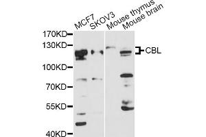 Western blot analysis of extracts of various cell lines, using CBL antibody. (CBL 抗体)